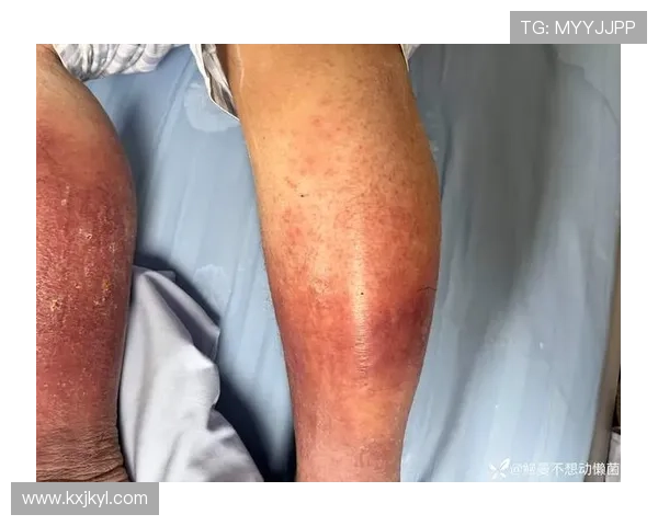 周懒予杯关键对决叶长欣涂季康陈家瑞丁柯文胜负手焦点全景解析展